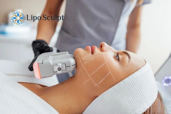 HIFU vs Botulinum Toxin: Understanding the Differences 1 HIFU vs Botox Berkhamsted What is the best option for you?