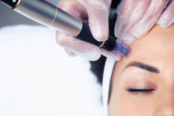 Explaining Total Skin Tightening Treatment and What to Expect 2 What Skin Concerns Can Total Skin Tightening Treatment Help With Berkhamsted?